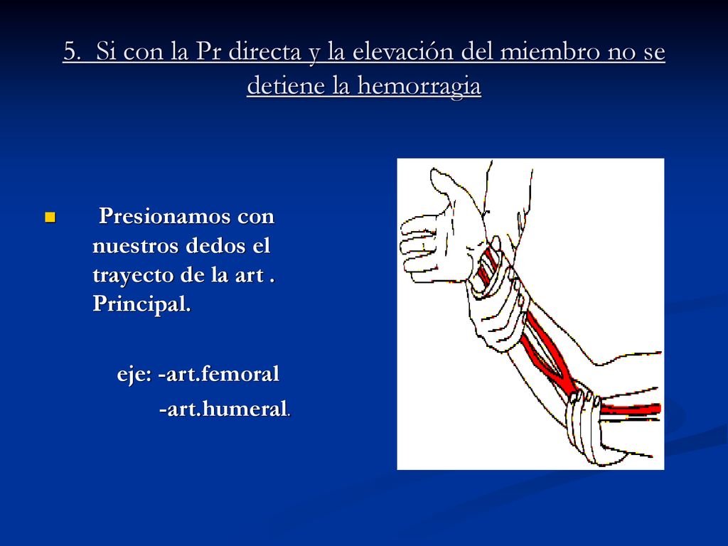 5. Si con la Pr directa y la elevación del miembro no se detiene la hemorragia