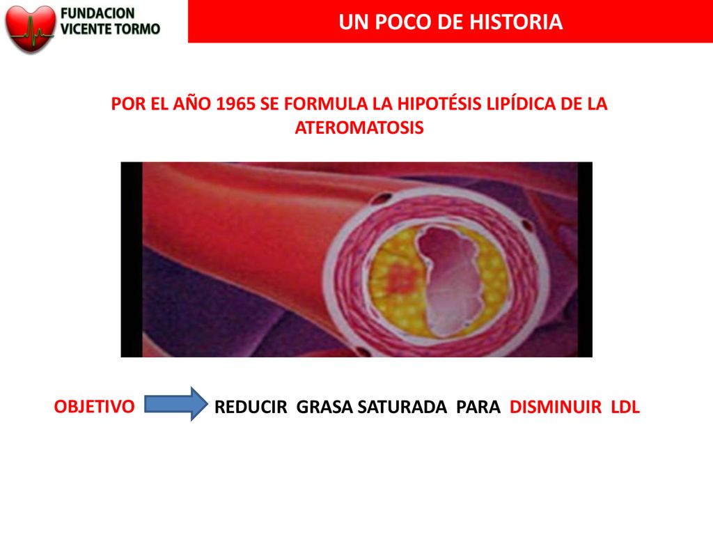 POR EL AÑO 1965 SE FORMULA LA HIPOTÉSIS LIPÍDICA DE LA ATEROMATOSIS