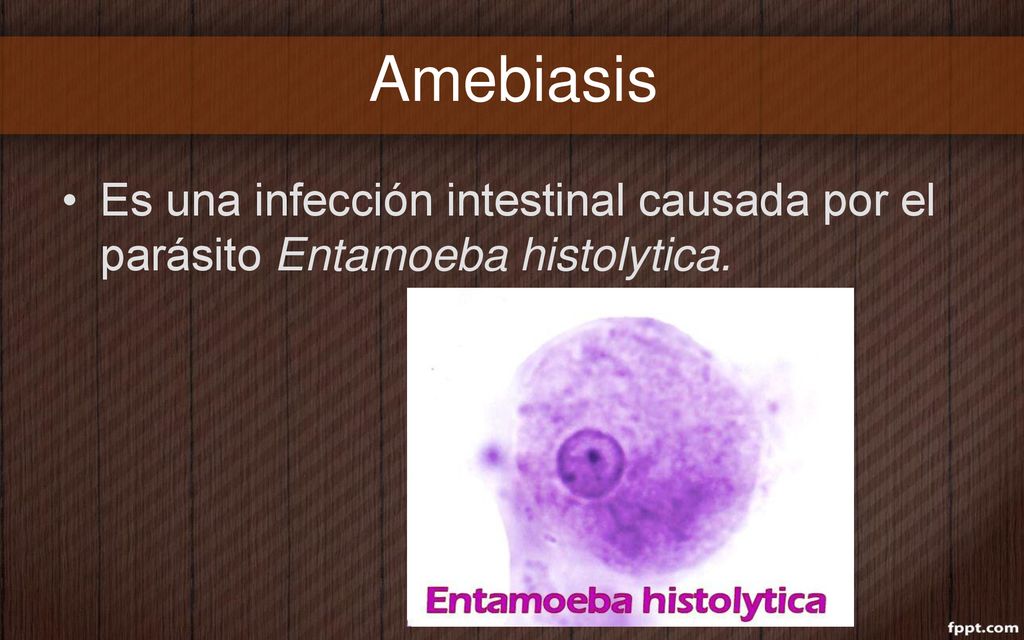 Amebiasis Es una infección intestinal causada por el parásito Entamoeba histolytica.