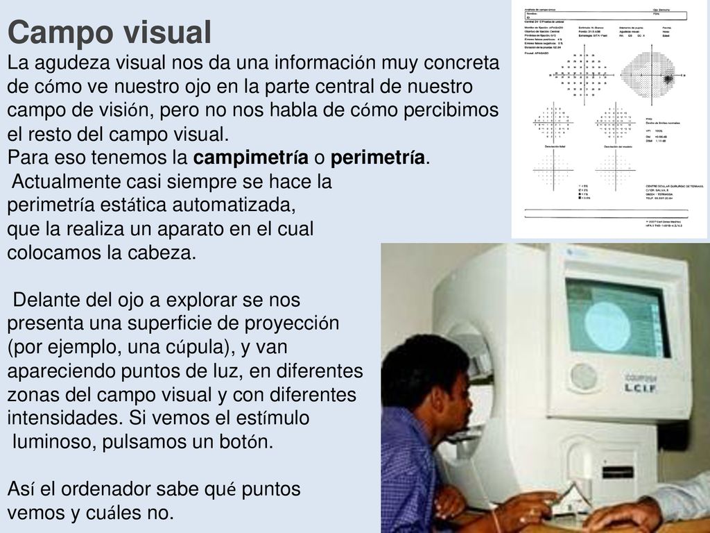Campo visual La agudeza visual nos da una información muy concreta