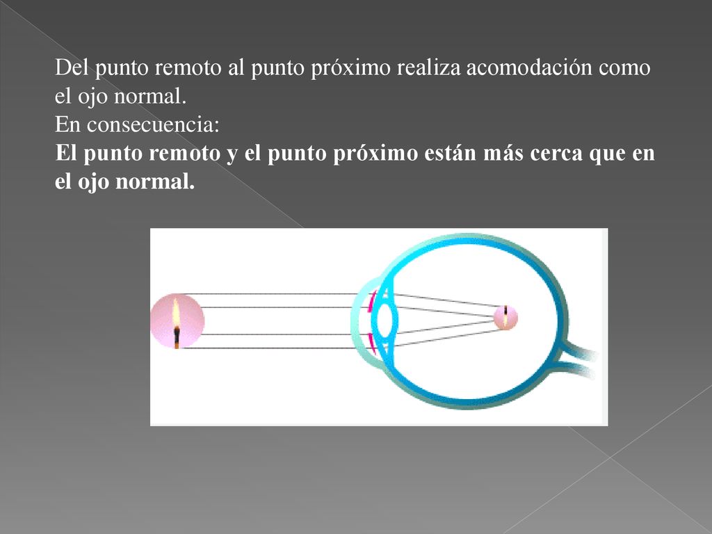 Del punto remoto al punto próximo realiza acomodación como el ojo normal.