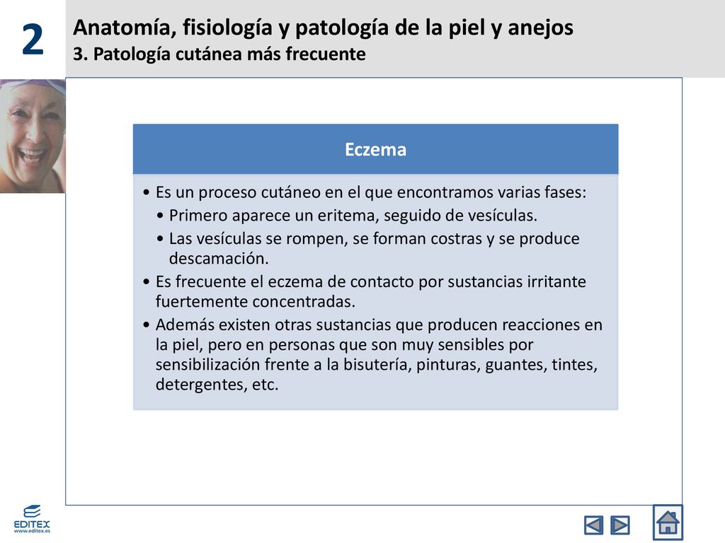 2 Anatomía, fisiología y patología de la piel y anejos 3. Patología cutánea más frecuente. Eczema.