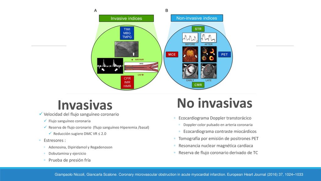 No invasivas Invasivas Velocidad del flujo sanguíneo coronario