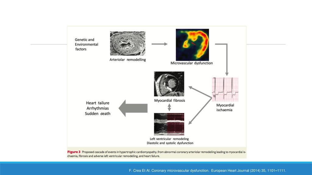 F. Crea Et Al. Coronary microvascular dysfunction