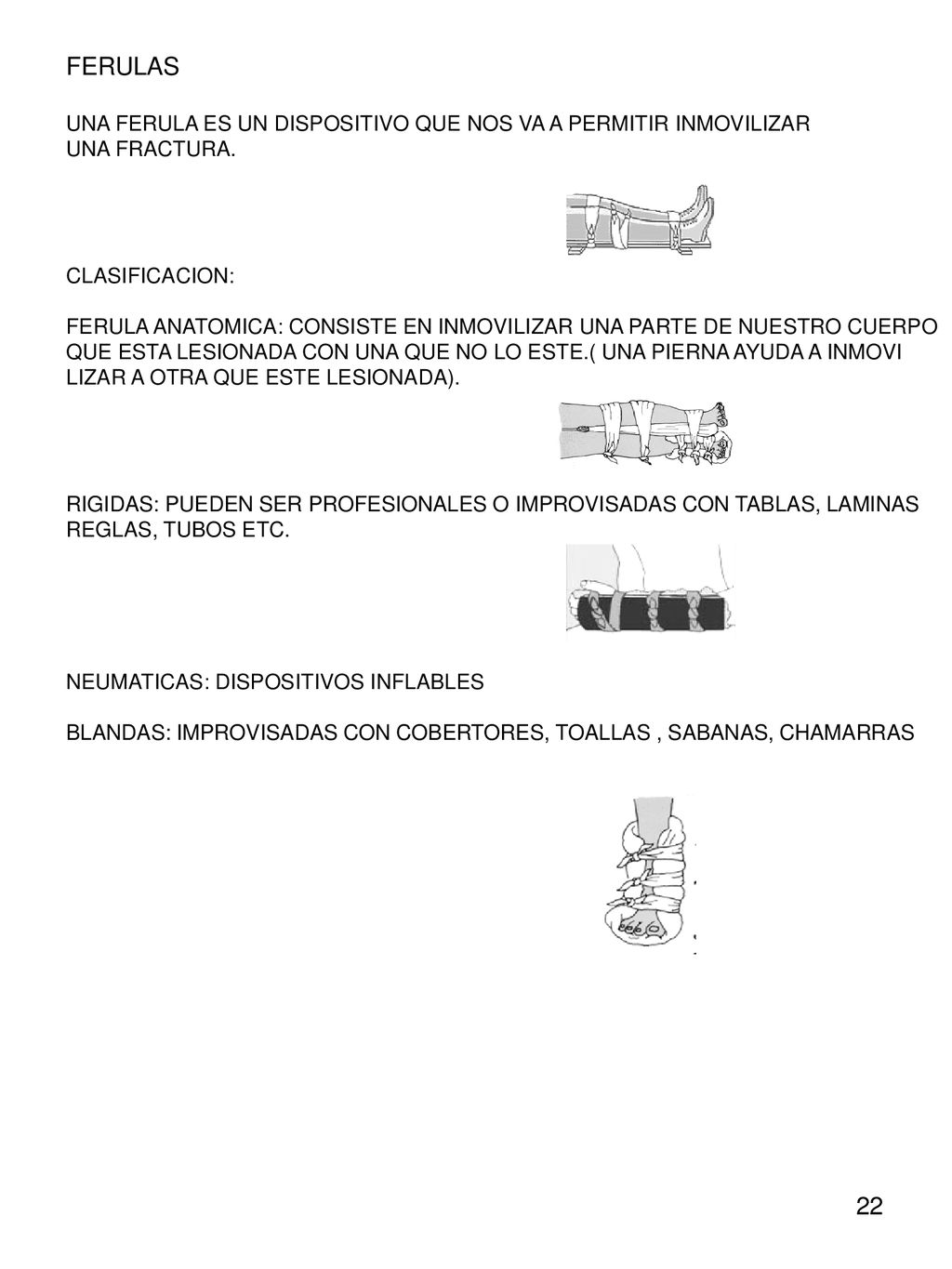 FERULAS UNA FERULA ES UN DISPOSITIVO QUE NOS VA A PERMITIR INMOVILIZAR. UNA FRACTURA. CLASIFICACION: