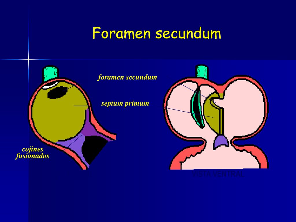 Foramen secundum VISTA VENTRAL VISTA LATERAL foramen secundum