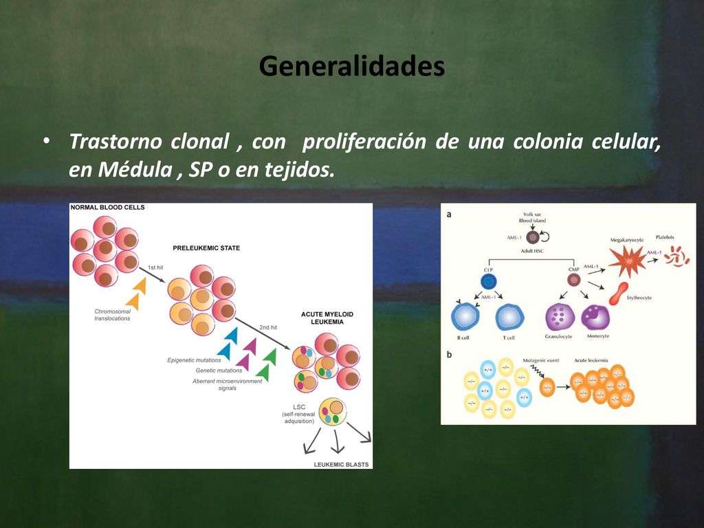 Generalidades Trastorno clonal , con proliferación de una colonia celular, en Médula , SP o en tejidos.
