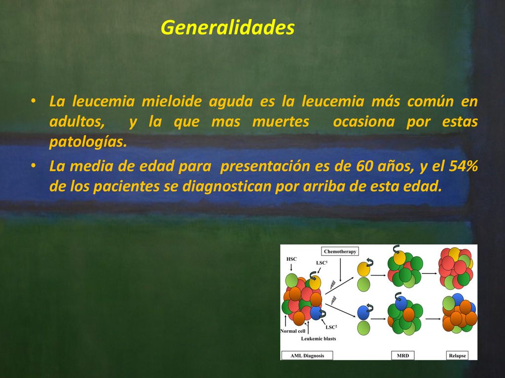 Generalidades La leucemia mieloide aguda es la leucemia más común en adultos, y la que mas muertes ocasiona por estas patologías.