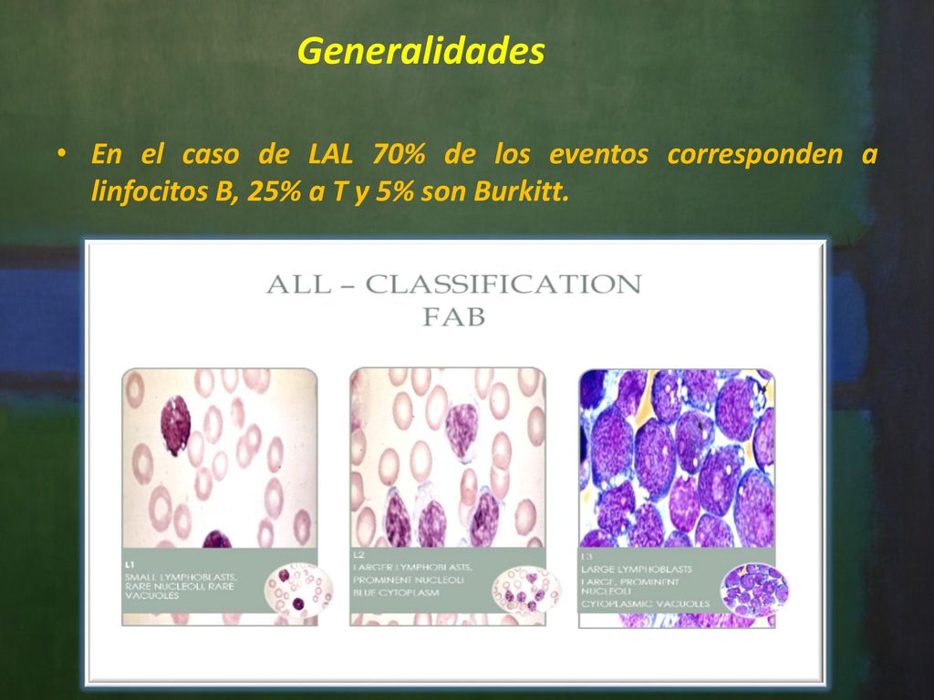 Generalidades En el caso de LAL 70% de los eventos corresponden a linfocitos B, 25% a T y 5% son Burkitt.