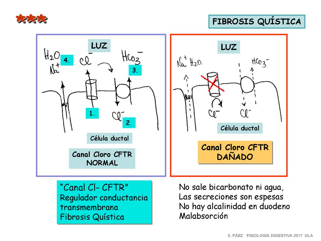 *** Canal Cl- CFTR FIBROSIS QUÍSTICA LUZ LUZ Canal Cloro CFTR DAÑADO