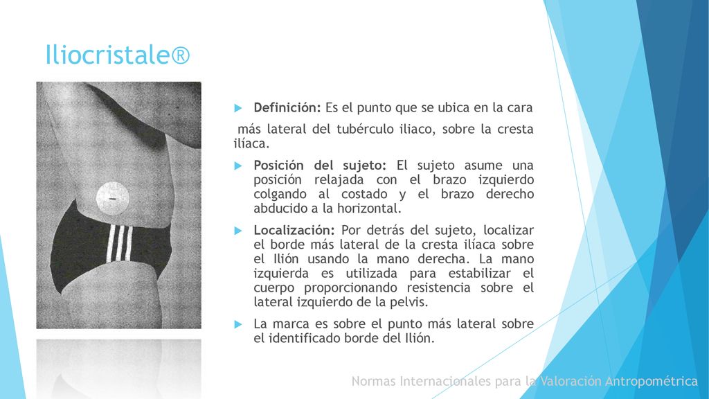 Iliocristale® Definición: Es el punto que se ubica en la cara