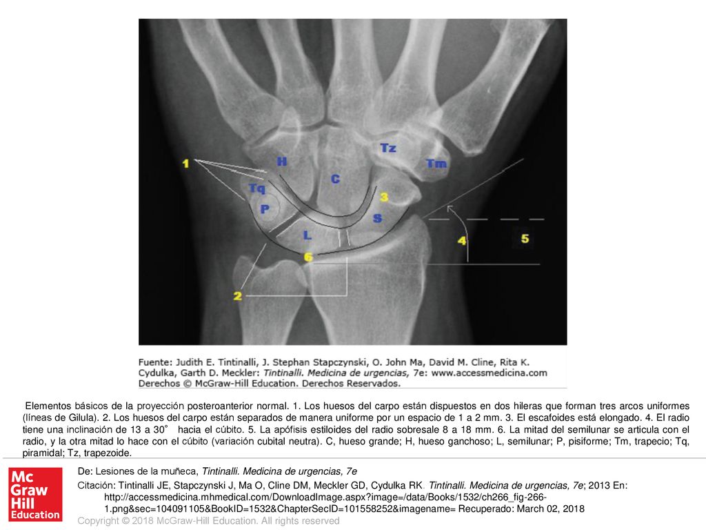 Elementos básicos de la proyección posteroanterior normal. 1