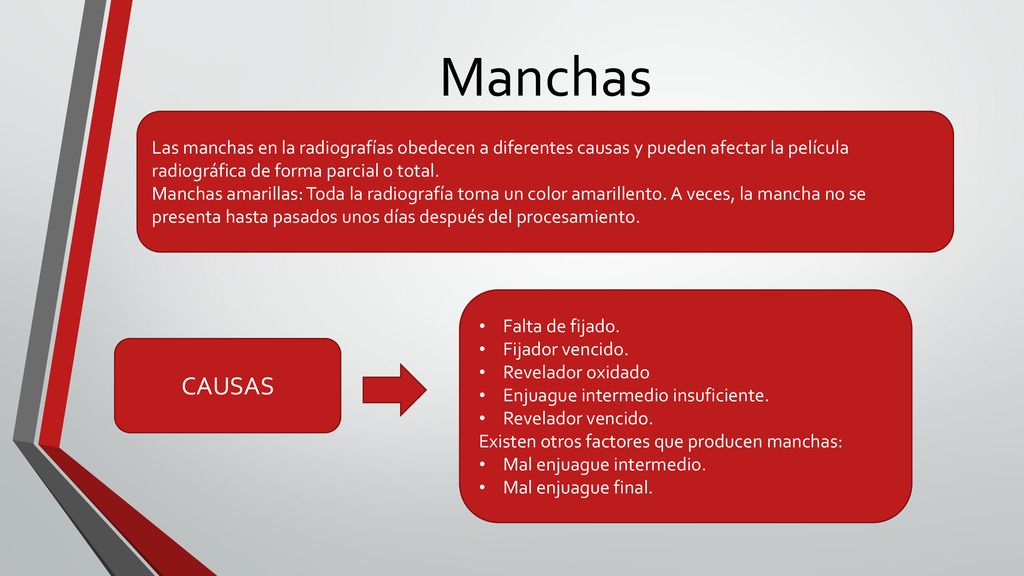 Manchas Las manchas en la radiografías obedecen a diferentes causas y pueden afectar la película radiográfica de forma parcial o total.