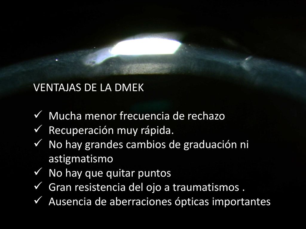 VENTAJAS DE LA DMEK Mucha menor frecuencia de rechazo. Recuperación muy rápida. No hay grandes cambios de graduación ni astigmatismo.