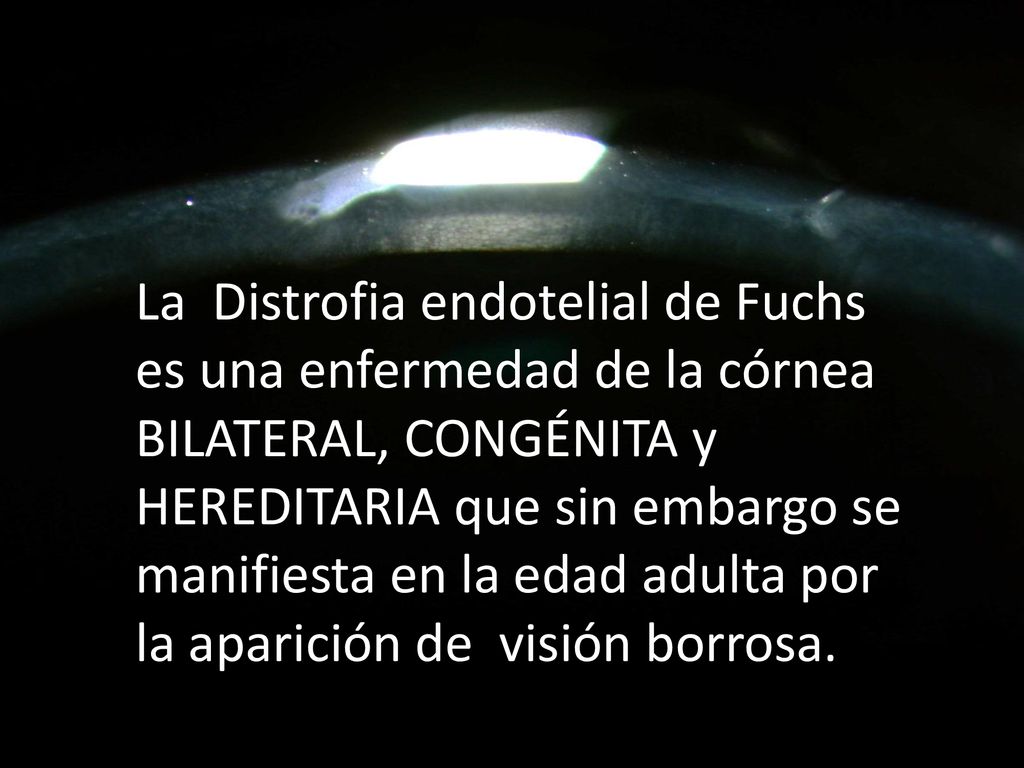 La Distrofia endotelial de Fuchs es una enfermedad de la córnea BILATERAL, CONGÉNITA y HEREDITARIA que sin embargo se manifiesta en la edad adulta por la aparición de visión borrosa.