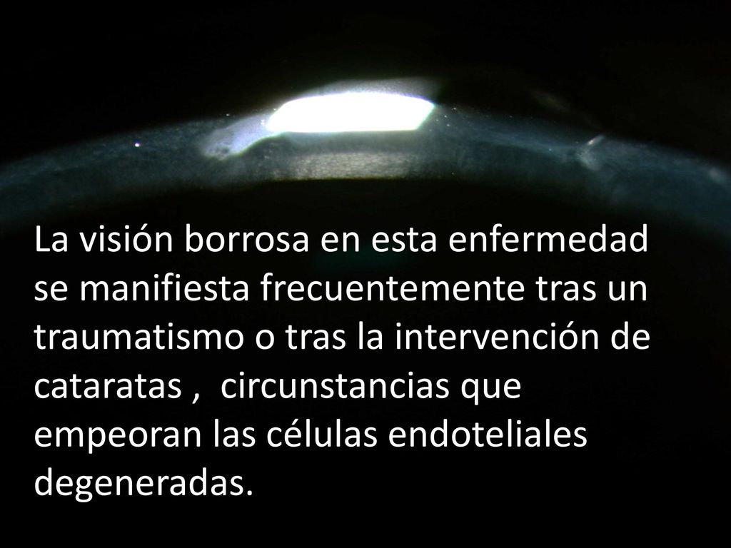La visión borrosa en esta enfermedad se manifiesta frecuentemente tras un traumatismo o tras la intervención de cataratas , circunstancias que empeoran las células endoteliales degeneradas.