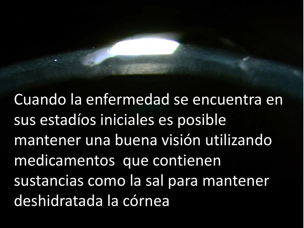 Cuando la enfermedad se encuentra en sus estadíos iniciales es posible mantener una buena visión utilizando medicamentos que contienen sustancias como la sal para mantener deshidratada la córnea