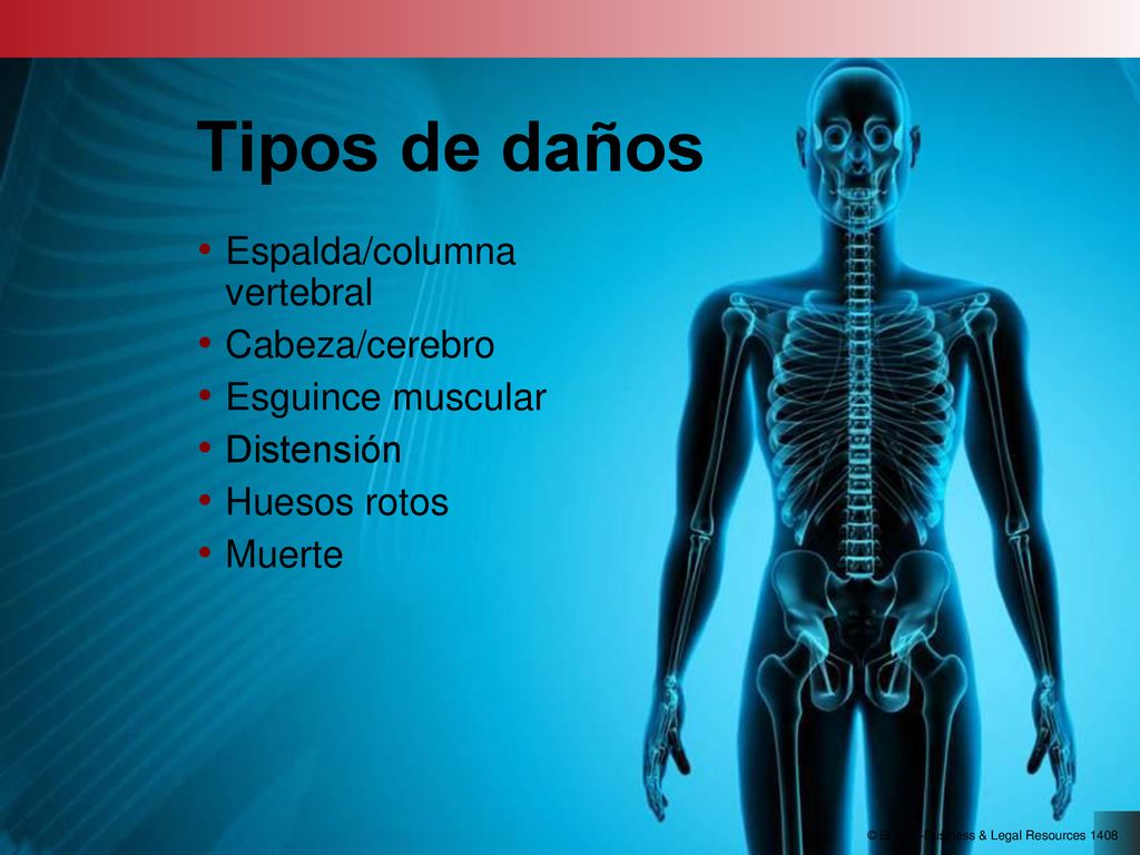 Tipos de daños Tipos de daños Espalda/columna vertebral Cabeza/cerebro
