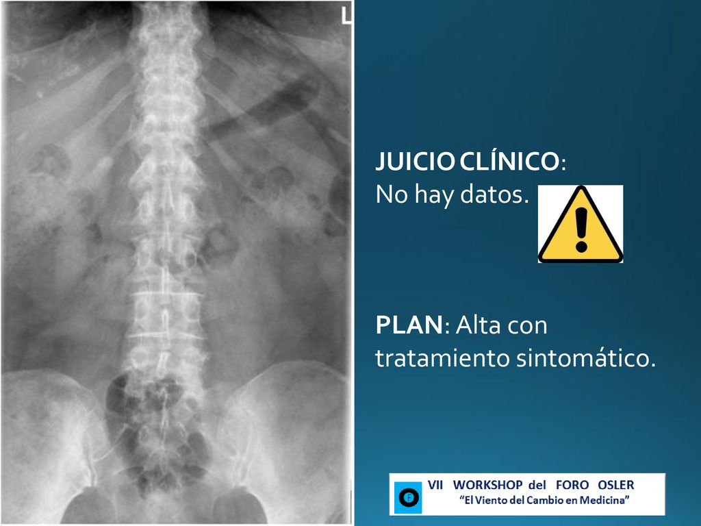 JUICIO CLÍNICO: No hay datos. PLAN: Alta con tratamiento sintomático.