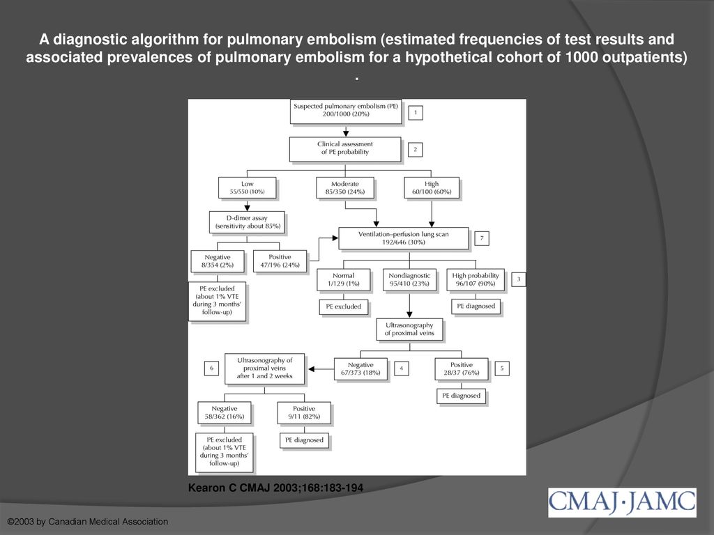 A diagnostic algorithm for pulmonary embolism (estimated frequencies of test results and associated prevalences of pulmonary embolism for a hypothetical cohort of 1000 outpatients) .