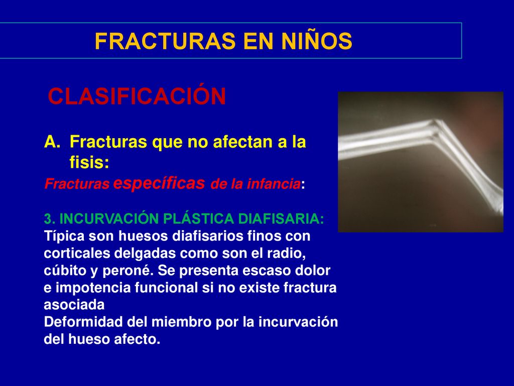 FRACTURAS EN NIÑOS CLASIFICACIÓN Fracturas que no afectan a la fisis: