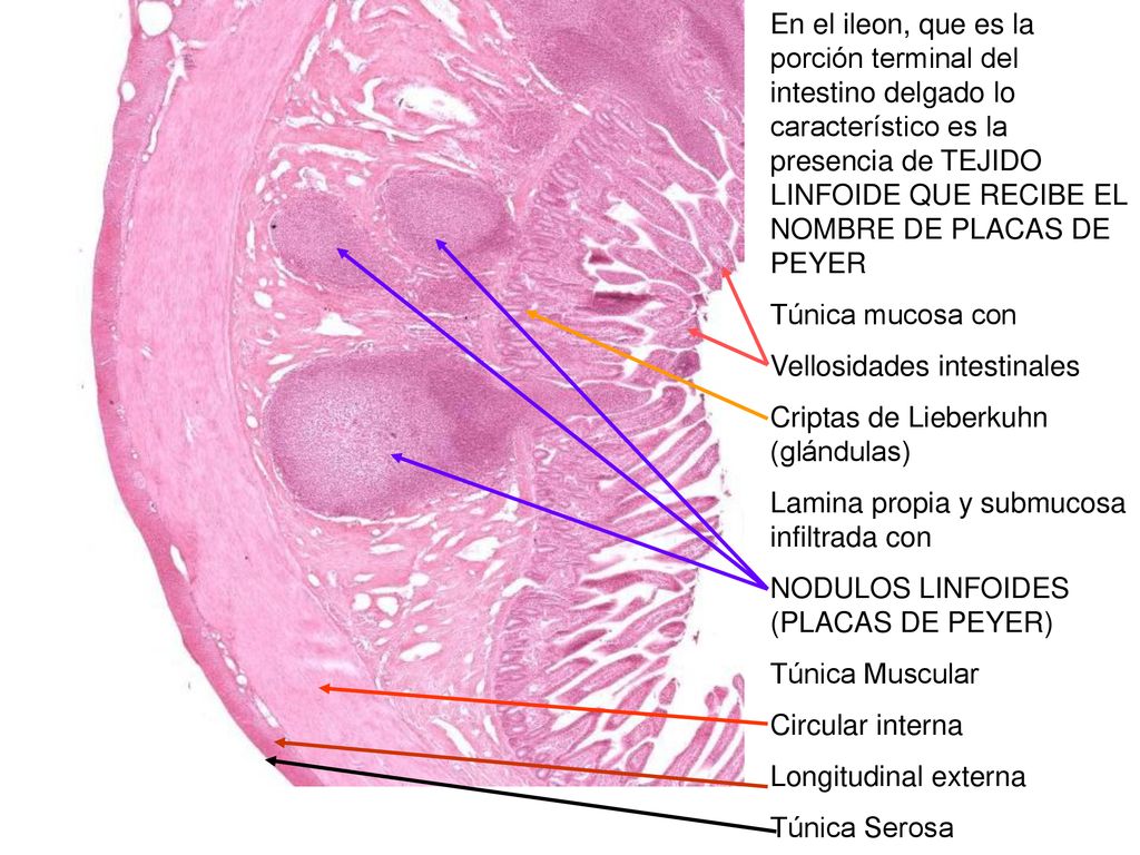 En el ileon, que es la porción terminal del intestino delgado lo característico es la presencia de TEJIDO LINFOIDE QUE RECIBE EL NOMBRE DE PLACAS DE PEYER