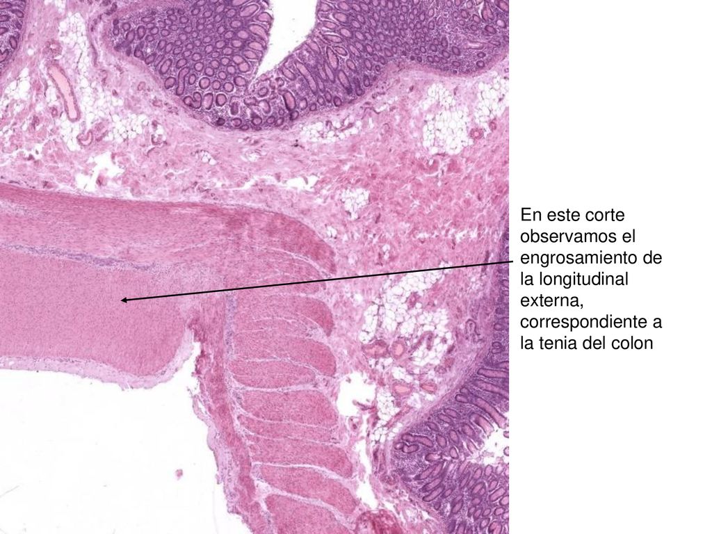 En este corte observamos el engrosamiento de la longitudinal externa, correspondiente a la tenia del colon