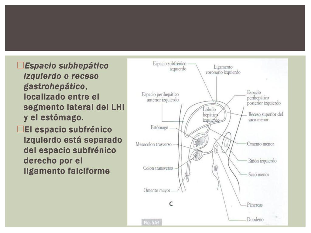 Espacio subhepático izquierdo o receso gastrohepático, localizado entre el segmento lateral del LHI y el estómago.