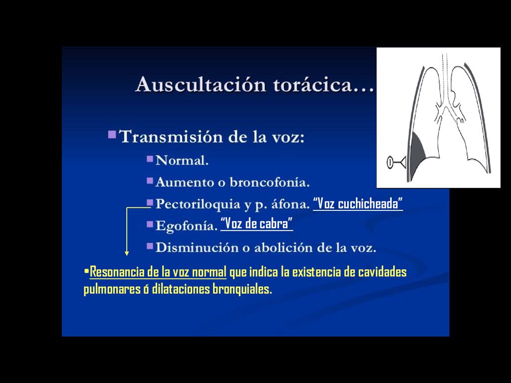 Voz cuchicheada Voz de cabra Resonancia de la voz normal que indica la existencia de cavidades pulmonares ó dilataciones bronquiales.