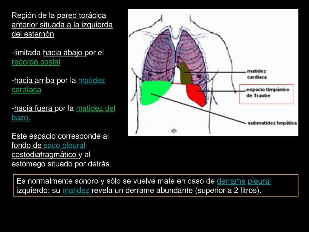 Región de la pared torácica anterior situada a la izquierda del esternón