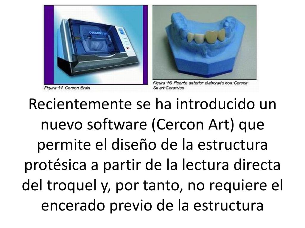 Recientemente se ha introducido un nuevo software (Cercon Art) que permite el diseño de la estructura protésica a partir de la lectura directa del troquel y, por tanto, no requiere el encerado previo de la estructura