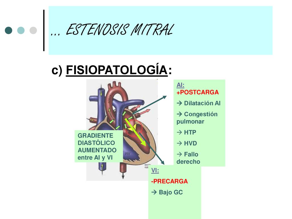 … ESTENOSIS MITRAL c) FISIOPATOLOGÍA: AI: +POSTCARGA  Dilatación AI