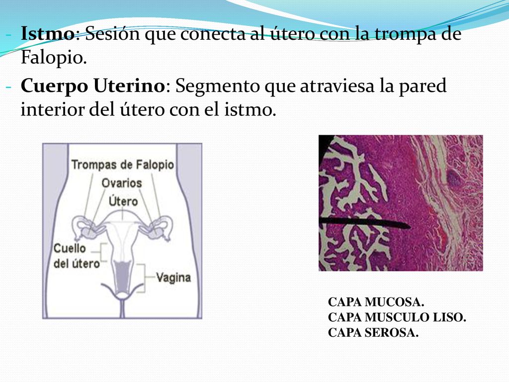 Istmo: Sesión que conecta al útero con la trompa de Falopio.