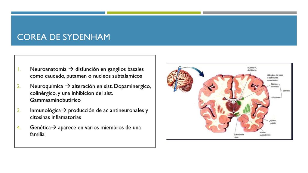 Corea de sydenham Neuroanatomía  disfunción en ganglios basales como caudado, putamen o nucleos subtalamicos.