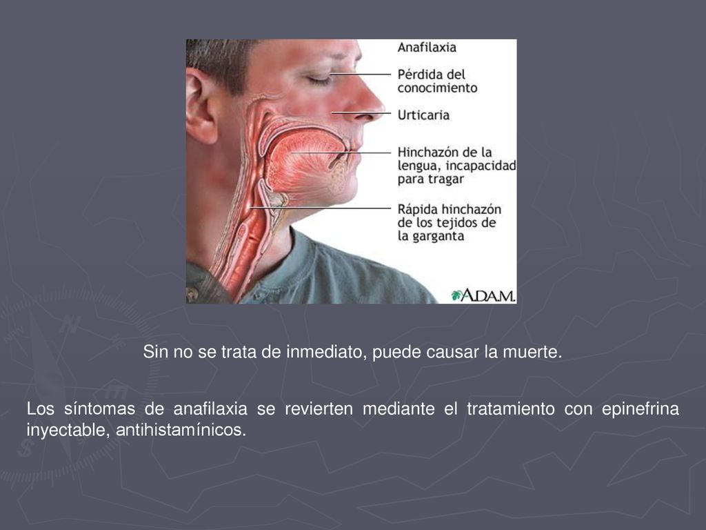 Sin no se trata de inmediato, puede causar la muerte.