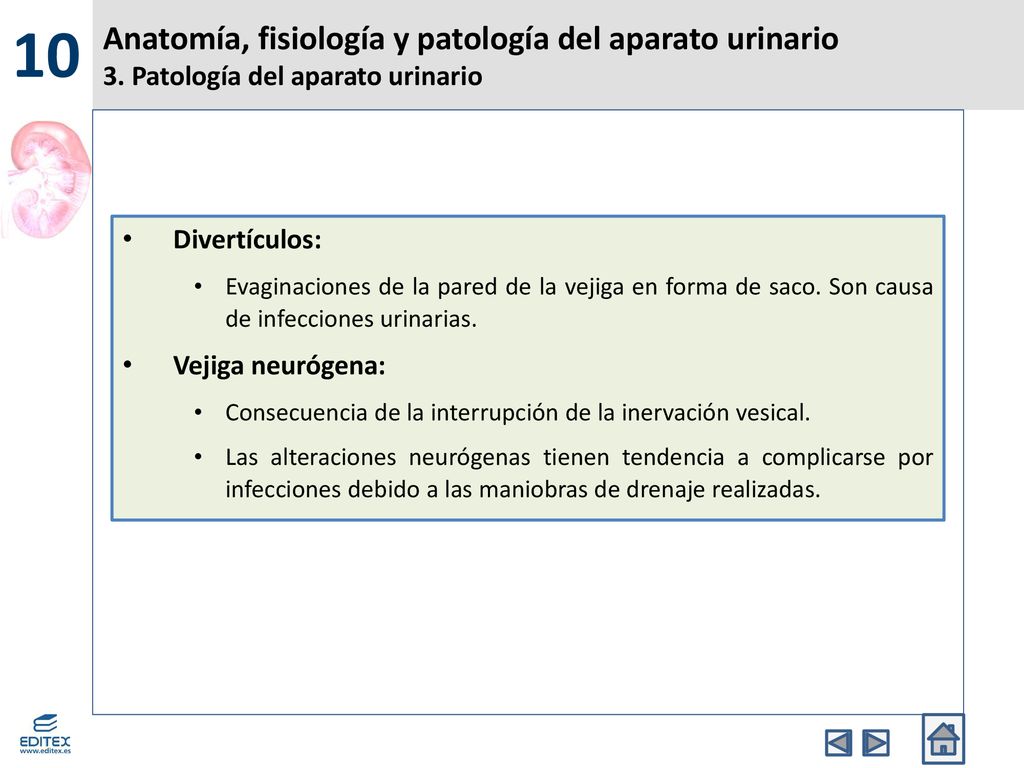 10 Anatomía, fisiología y patología del aparato urinario 3. Patología del aparato urinario. Divertículos: