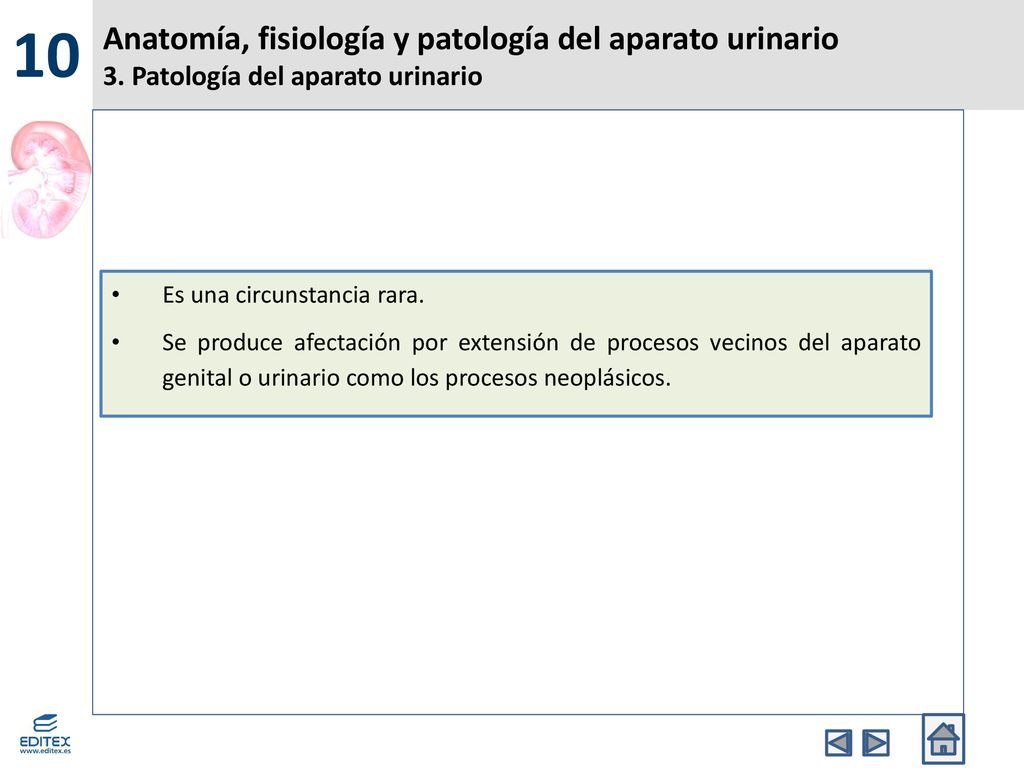 10 Anatomía, fisiología y patología del aparato urinario 3. Patología del aparato urinario. Es una circunstancia rara.