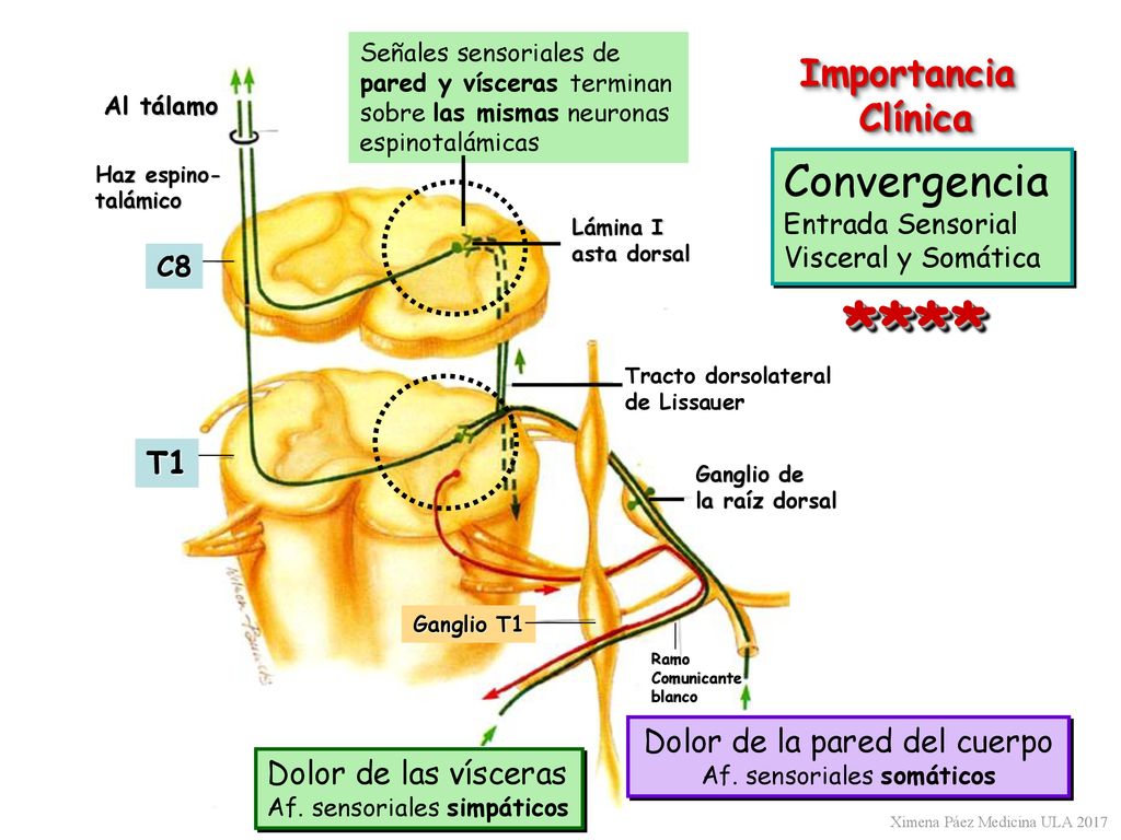 **** Convergencia Importancia Clínica T1 Dolor de la pared del cuerpo