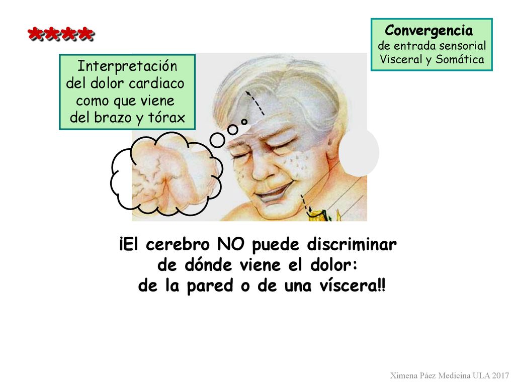 **** ¡El cerebro NO puede discriminar de dónde viene el dolor: