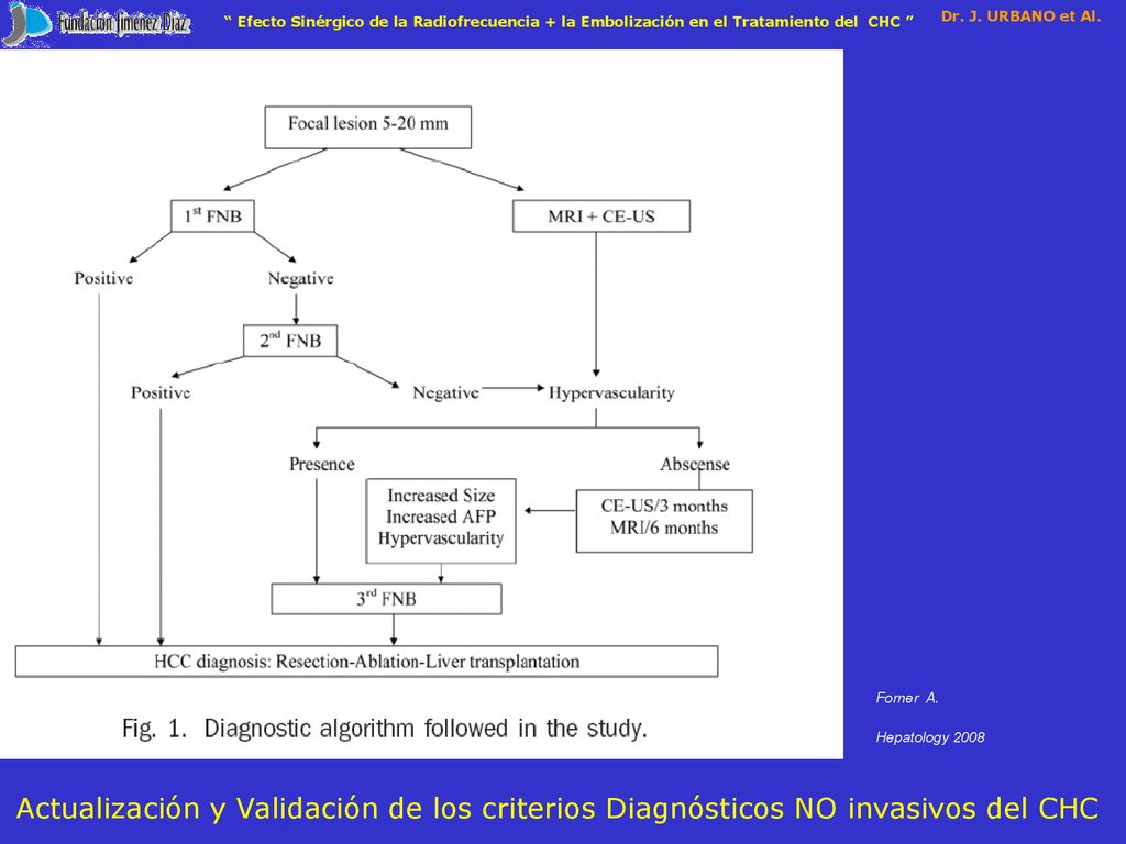 Efecto Sinérgico de la Radiofrecuencia + la Embolización en el Tratamiento del CHC