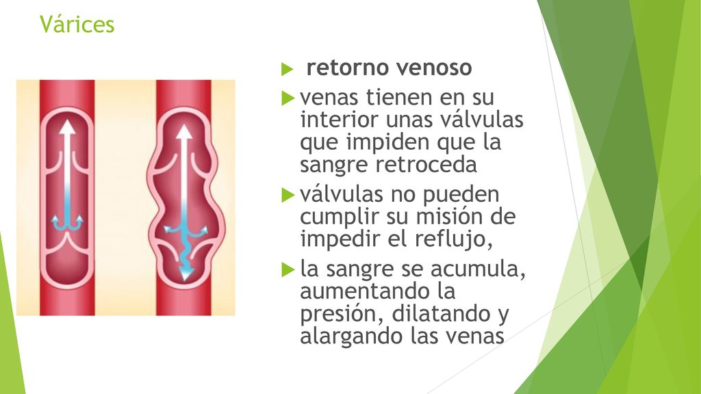 válvulas no pueden cumplir su misión de impedir el reflujo,
