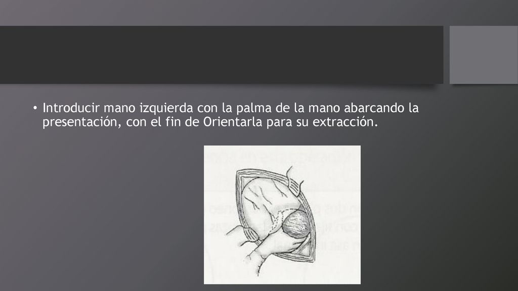 Introducir mano izquierda con la palma de la mano abarcando la presentación, con el fin de Orientarla para su extracción.