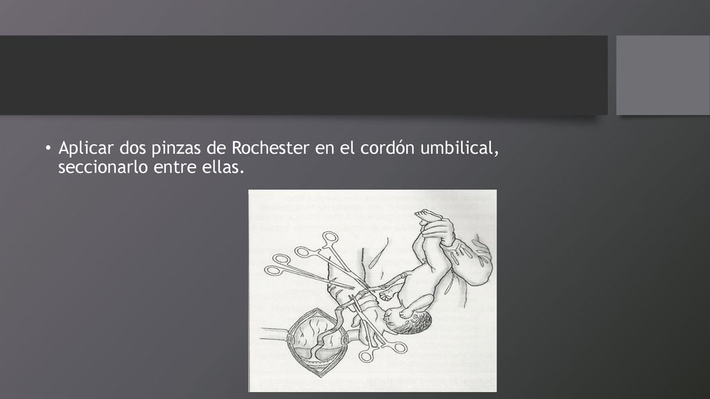 Aplicar dos pinzas de Rochester en el cordón umbilical, seccionarlo entre ellas.
