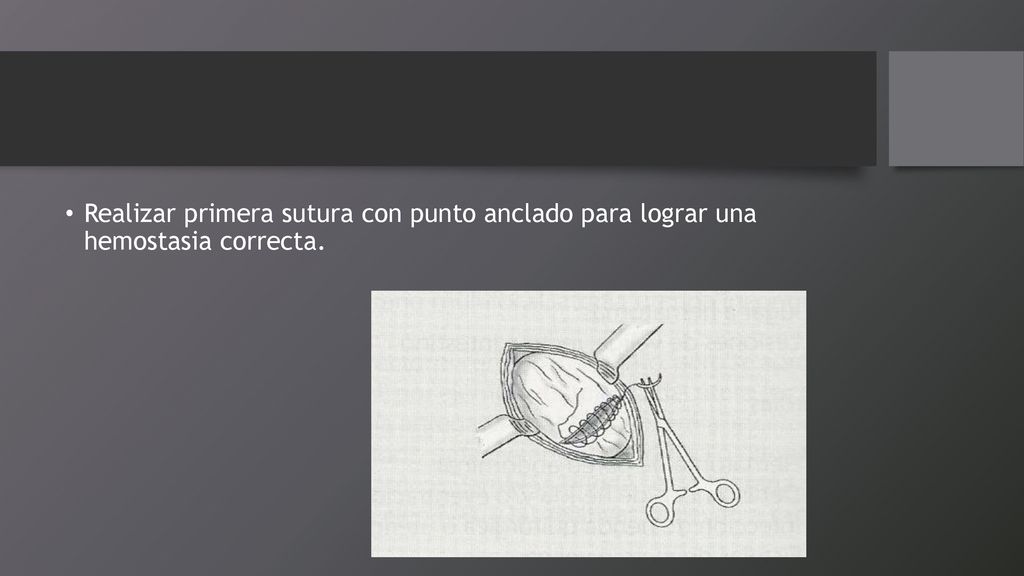 Realizar primera sutura con punto anclado para lograr una hemostasia correcta.