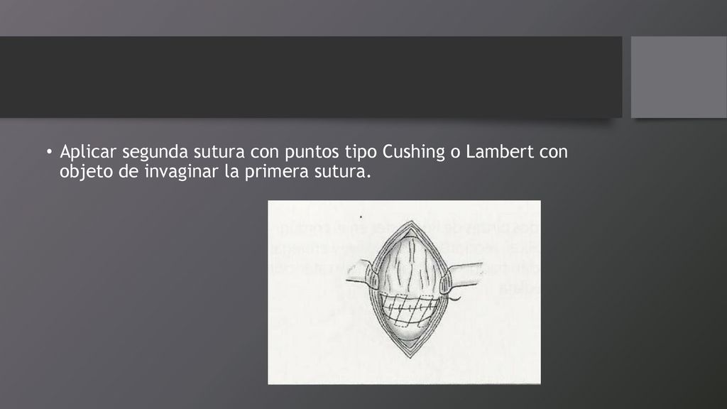 Aplicar segunda sutura con puntos tipo Cushing o Lambert con objeto de invaginar la primera sutura.