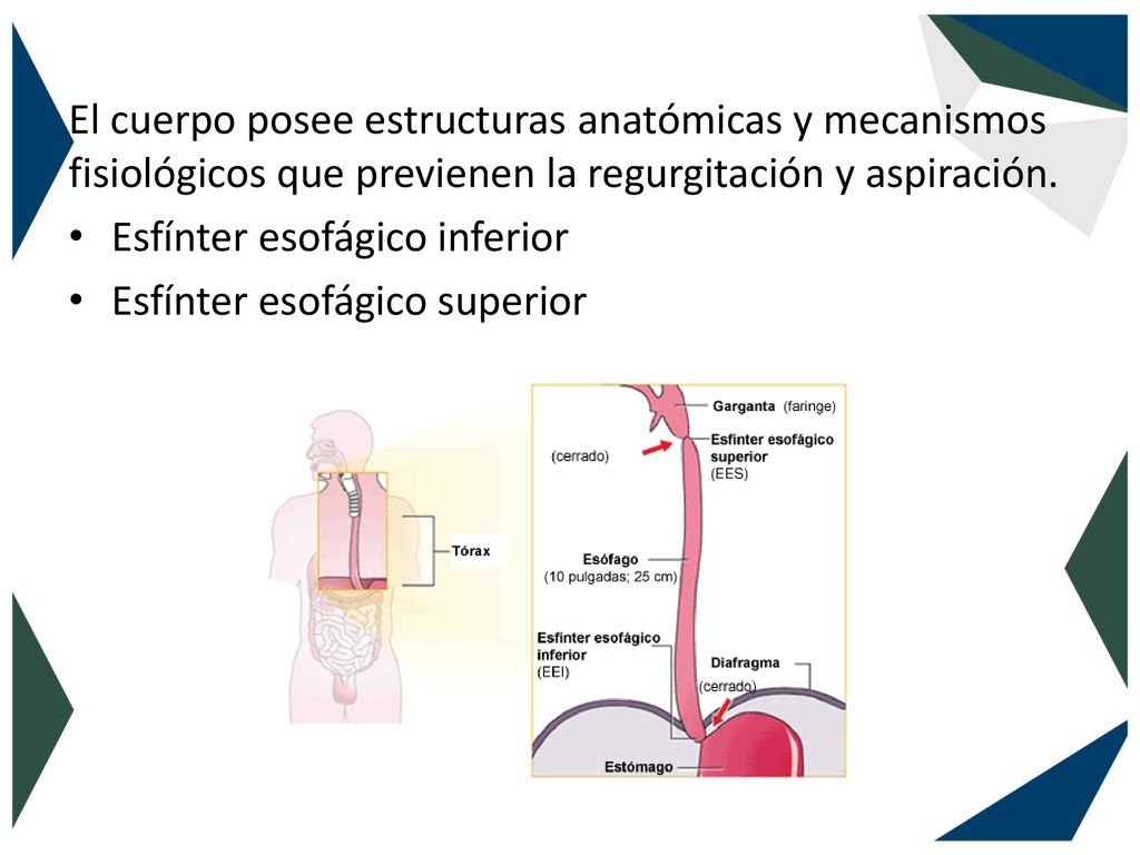 El cuerpo posee estructuras anatómicas y mecanismos fisiológicos que previenen la regurgitación y aspiración.