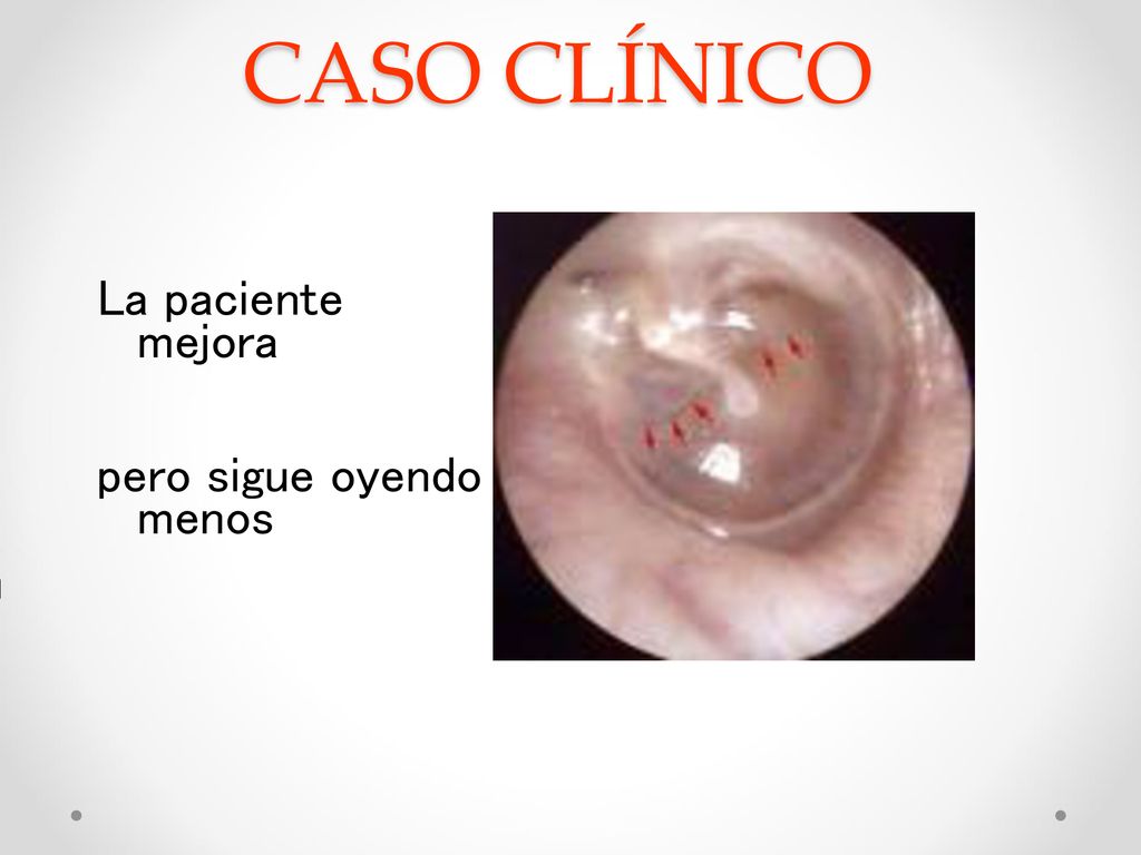 CASO CLÍNICO La paciente mejora pero sigue oyendo menos