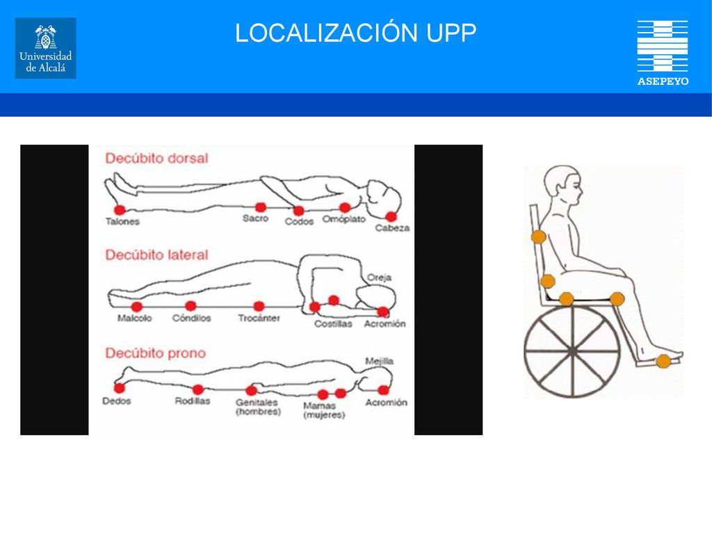 LOCALIZACIÓN UPP Actualmente la mejora de la seguridad de los pacientes se ha convertido en un.