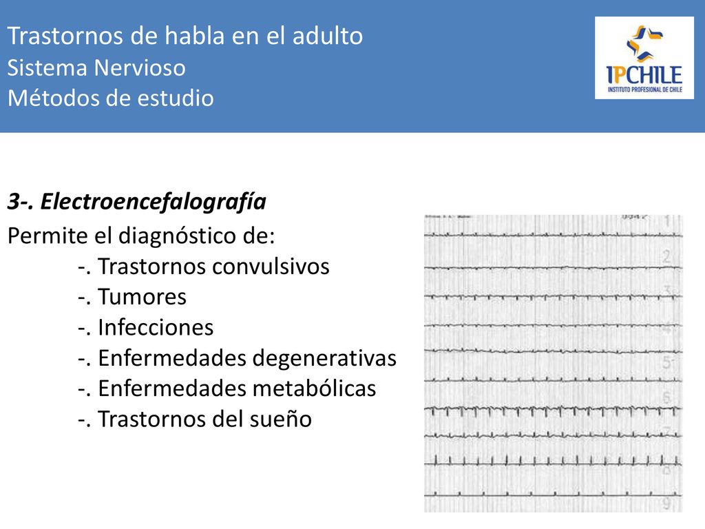 Trastornos de habla en el adulto Sistema Nervioso Métodos de estudio
