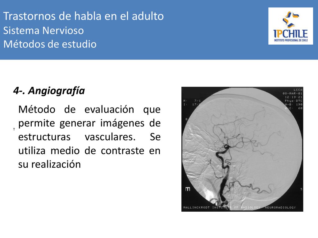 Trastornos de habla en el adulto Sistema Nervioso Métodos de estudio